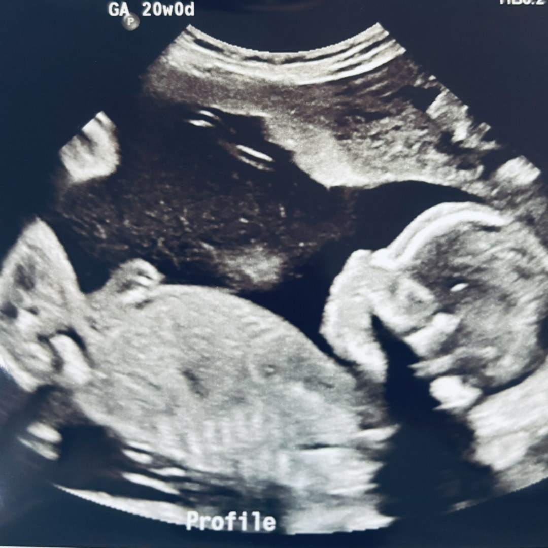 Photo shared by Mia for their Babylist baby registry.