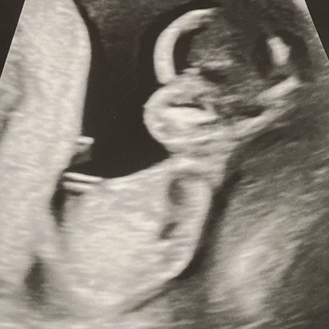 Photo shared by Alexa for their Babylist baby registry.