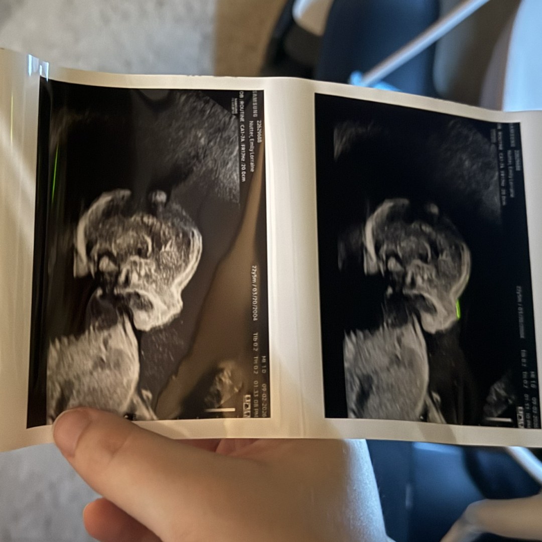 Photo shared by Emily for their Babylist baby registry.