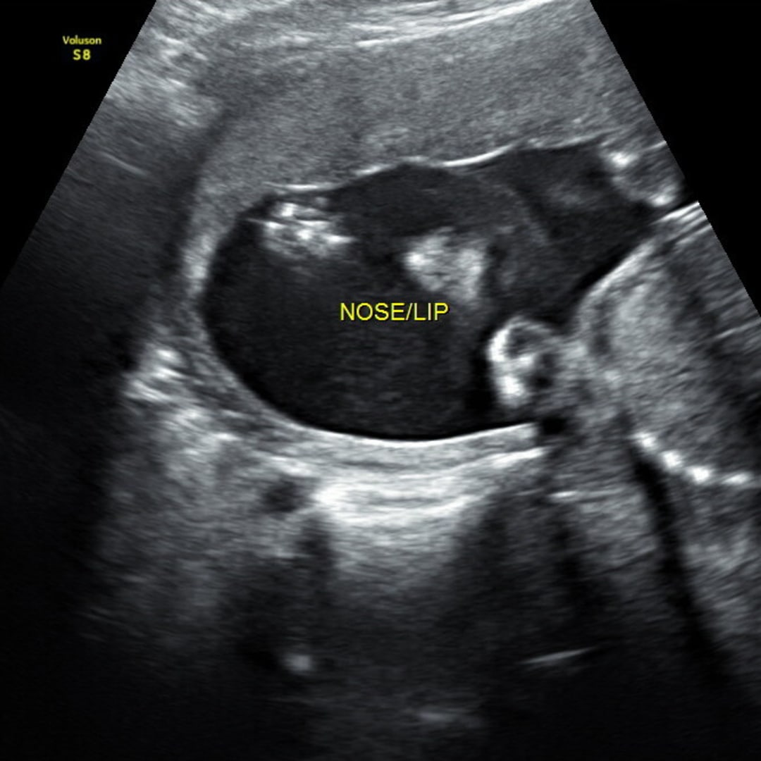 Photo shared by Madison for their Babylist baby registry.