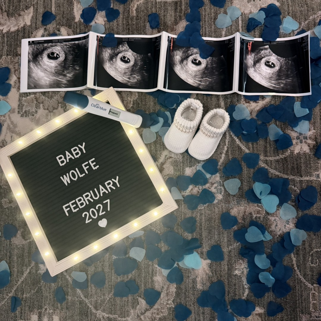 Photo shared by Anna for their Babylist baby registry.