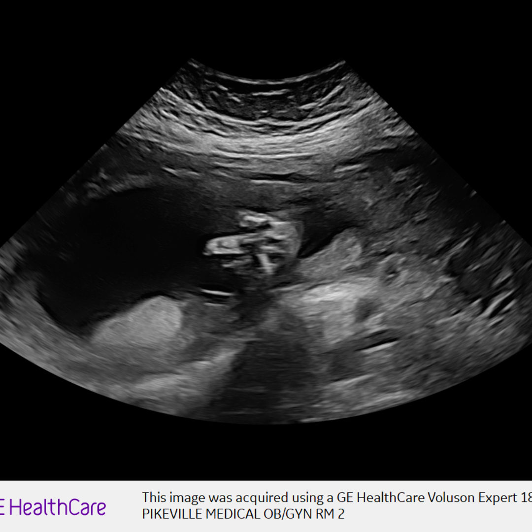 Photo shared by Allison for their Babylist baby registry.