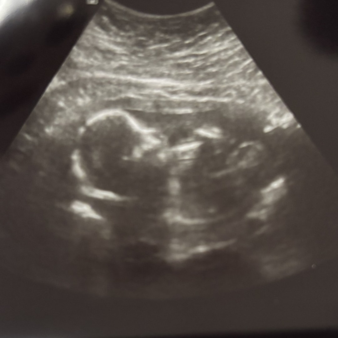 Photo shared by Yasmin for their Babylist baby registry.