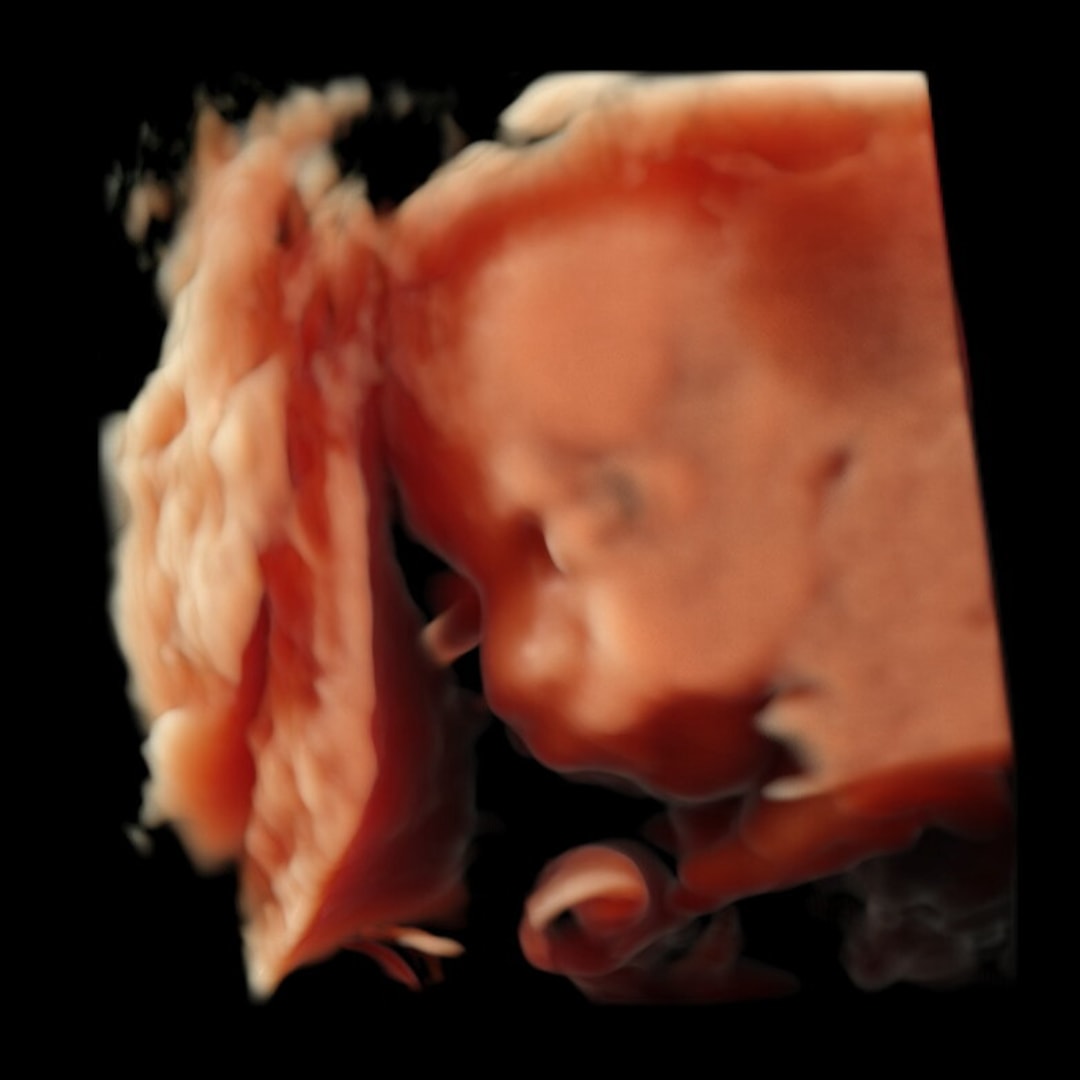 Photo shared by Raely for their Babylist baby registry.