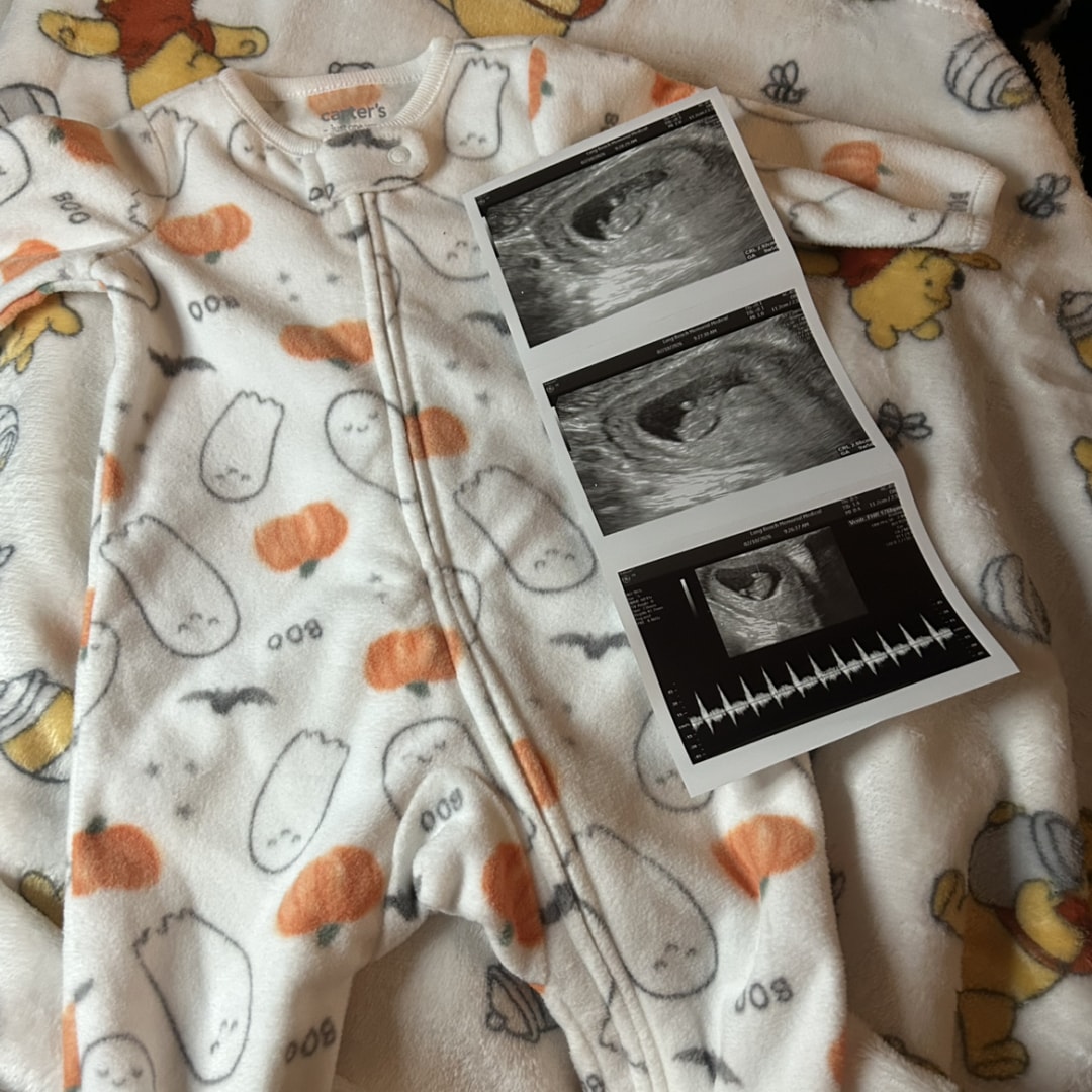 Photo shared by Summer for their Babylist baby registry.