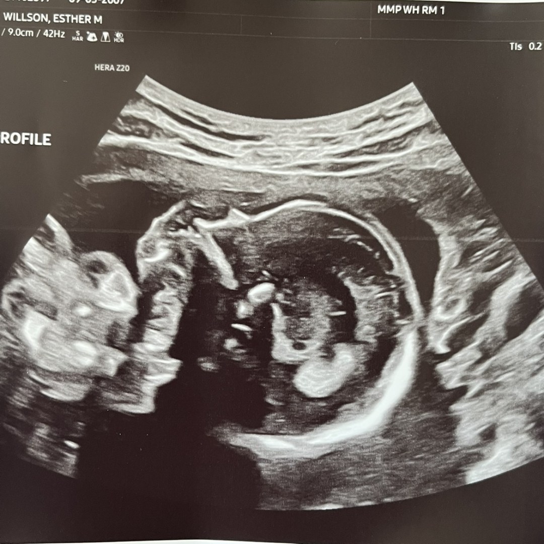 Photo shared by Esther for their Babylist baby registry.