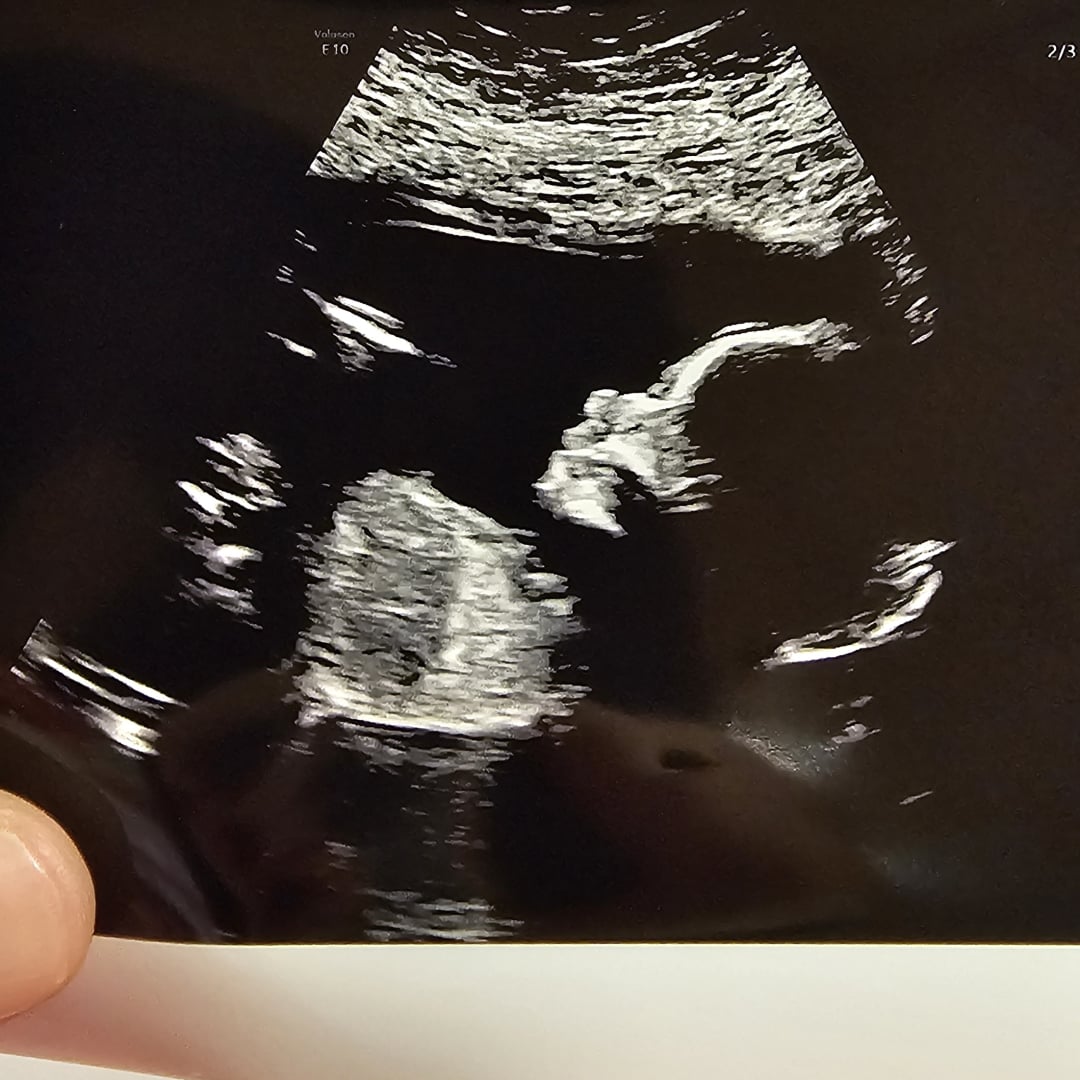 Photo shared by Kelsey for their Babylist baby registry.