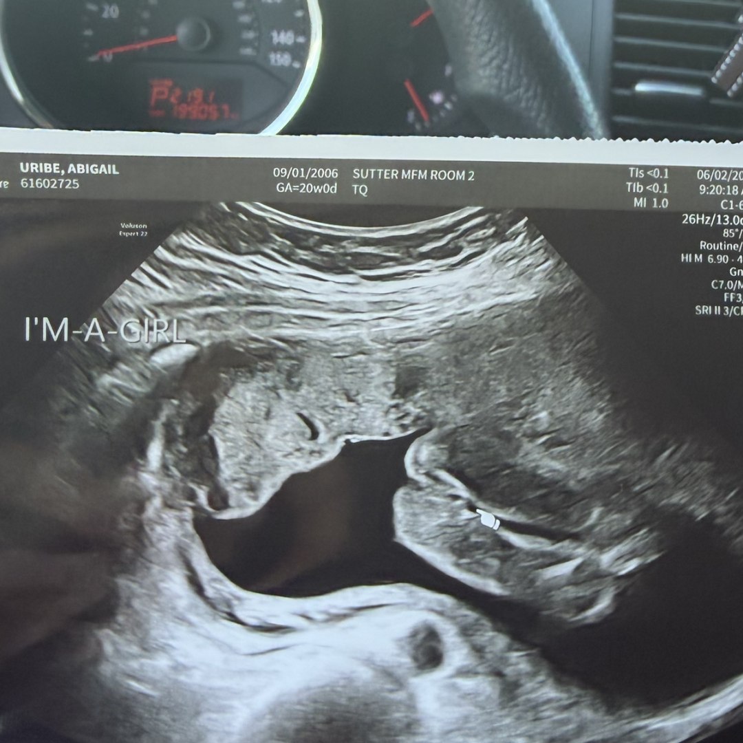 Photo shared by Abigail for their Babylist baby registry.