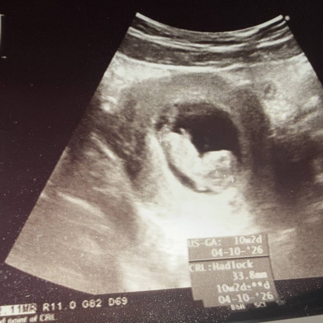 Photo shared by Alexia for their Babylist baby registry.