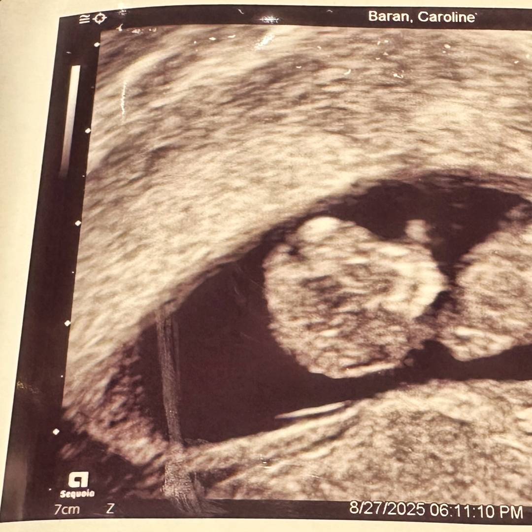 Photo shared by Caroline for their Babylist baby registry.