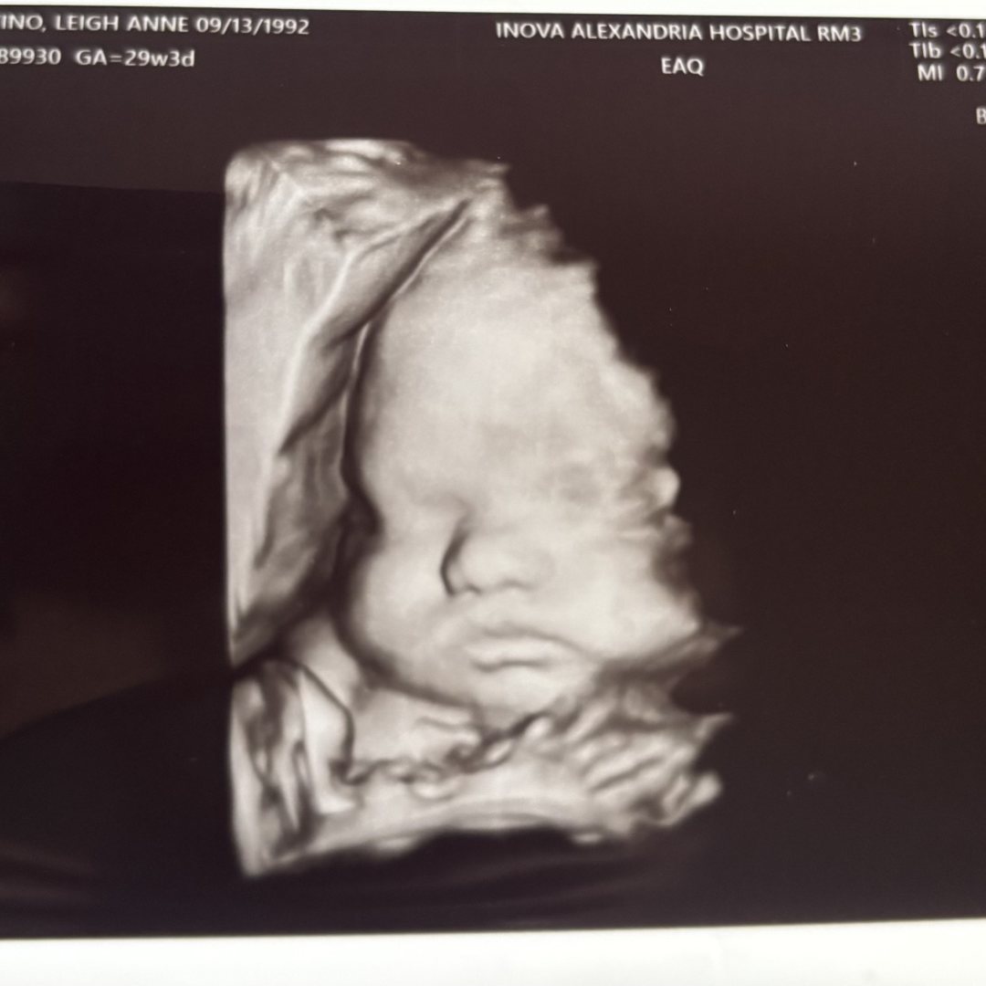 Photo shared by Leigh for their Babylist baby registry.