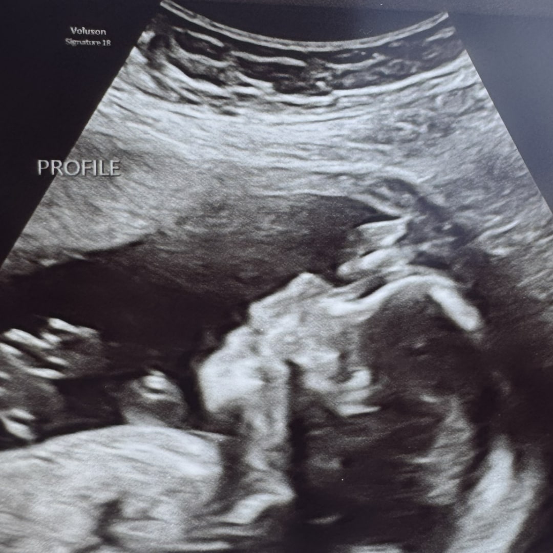 Photo shared by Jackie for their Babylist baby registry.