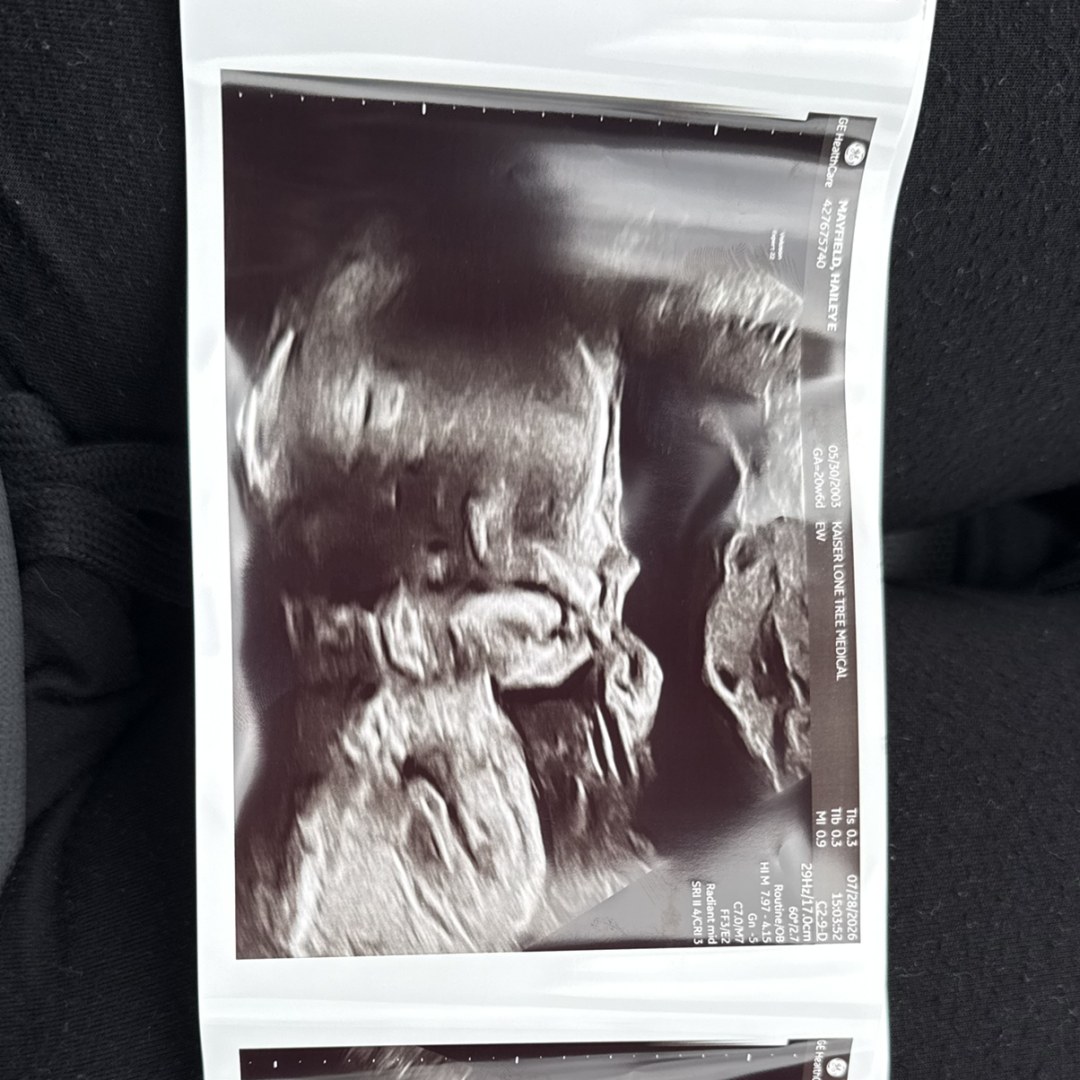 Photo shared by Hailey for their Babylist baby registry.
