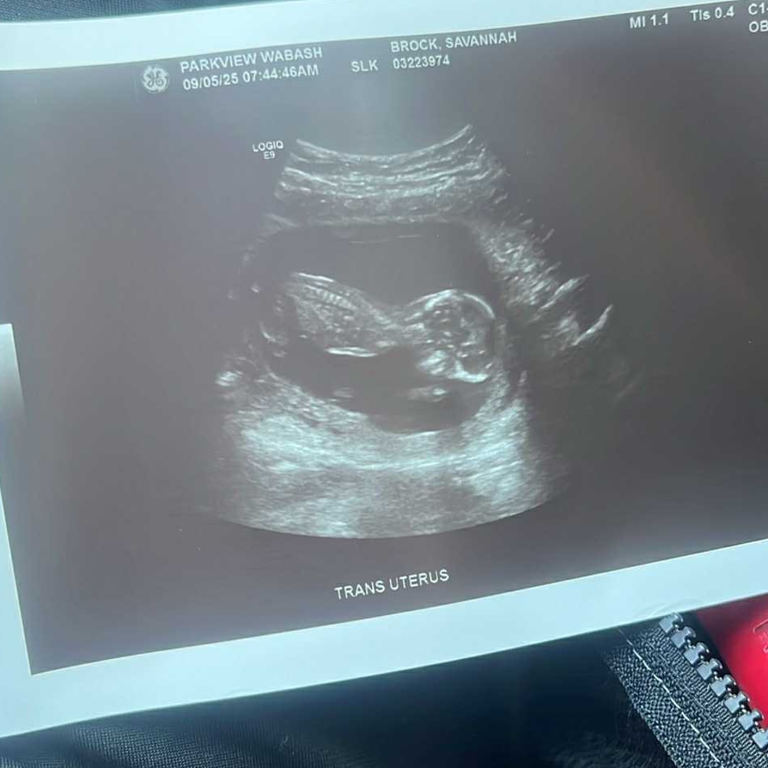 Photo shared by Savannah for their Babylist baby registry.