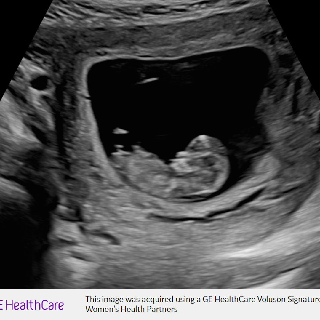 Photo shared by Katelin for their Babylist baby registry.