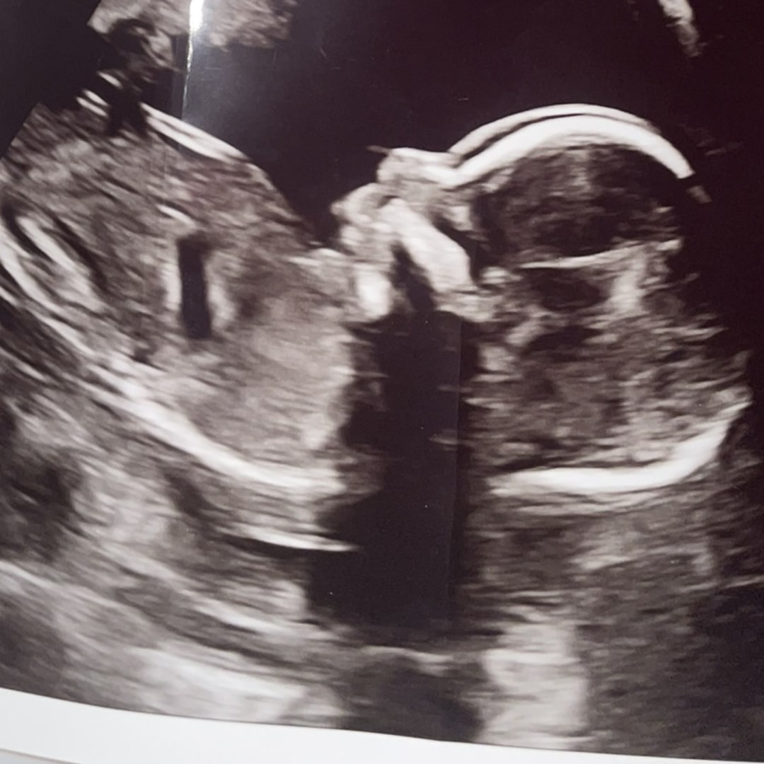 Photo shared by Kathryn for their Babylist baby registry.