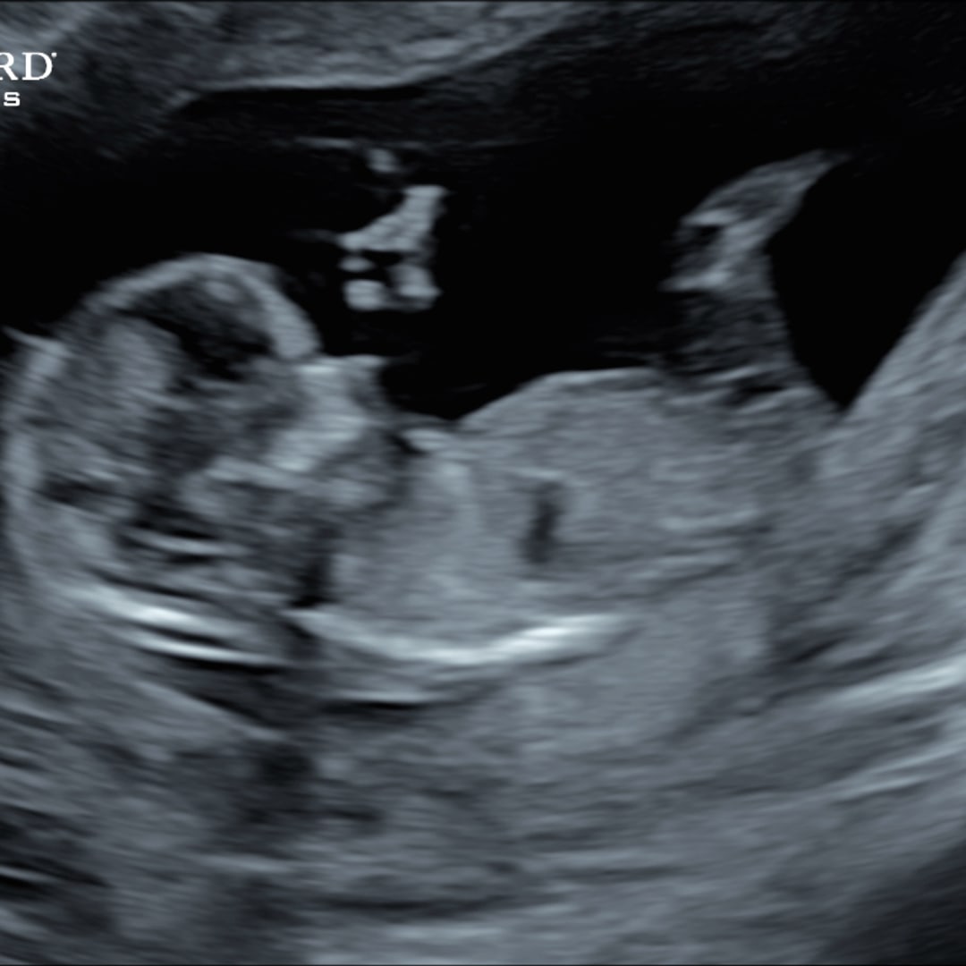 Photo shared by Jordan for their Babylist baby registry.