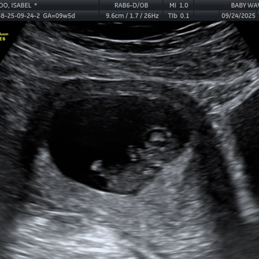 Photo shared by Isabel for their Babylist baby registry.