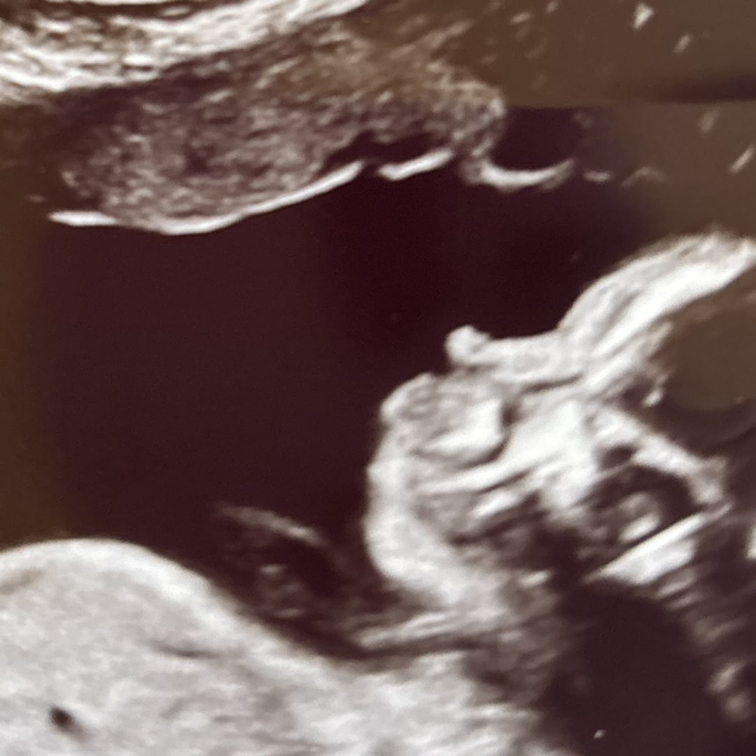Photo shared by Keeley for their Babylist baby registry.