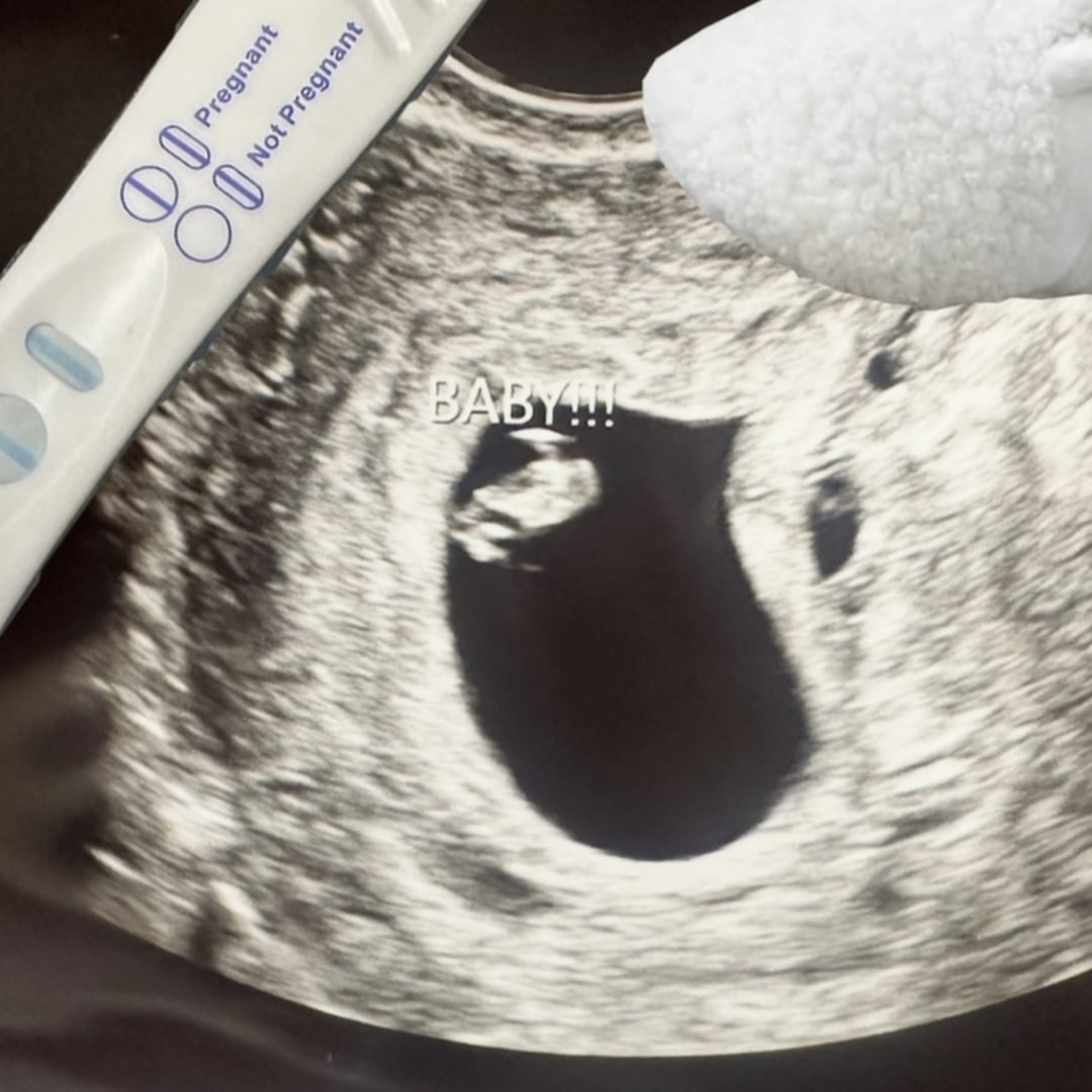 Photo shared by Samantha for their Babylist baby registry.