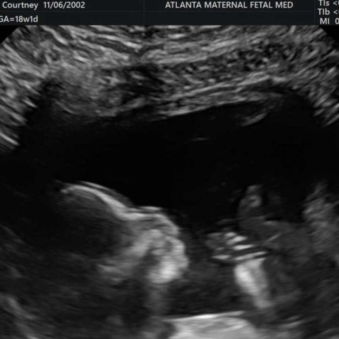 Photo shared by Courtney for their Babylist baby registry.