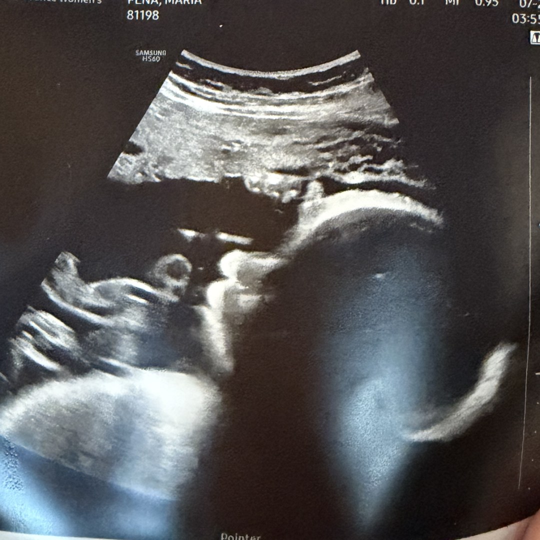 Photo shared by Maria for their Babylist baby registry.