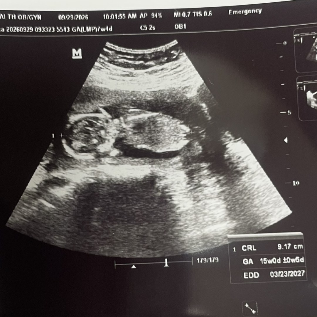 Photo shared by Erica for their Babylist baby registry.