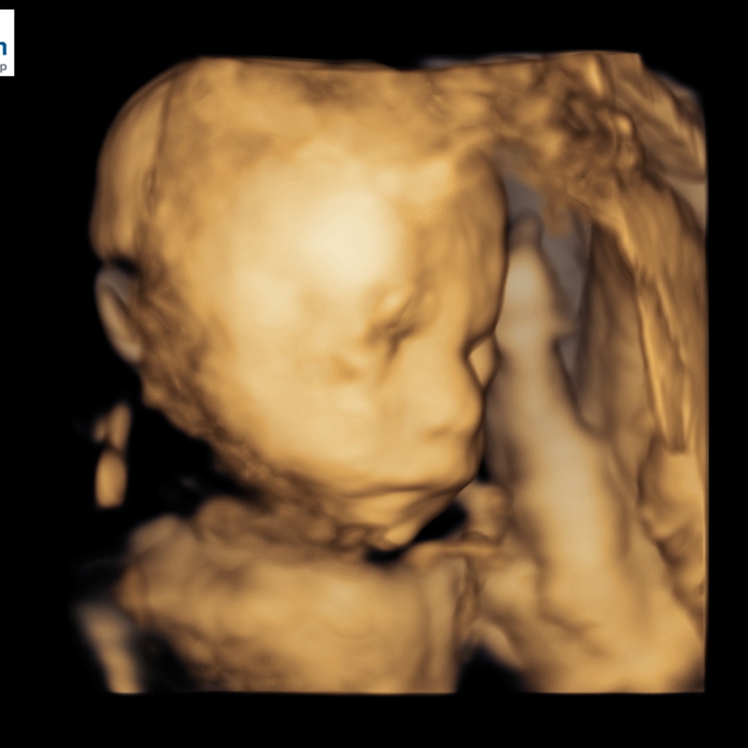 Photo shared by Maddy for their Babylist baby registry.
