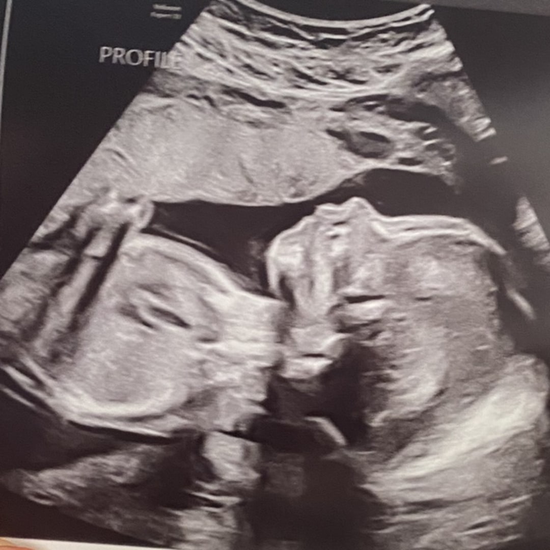Photo shared by Veronica for their Babylist baby registry.