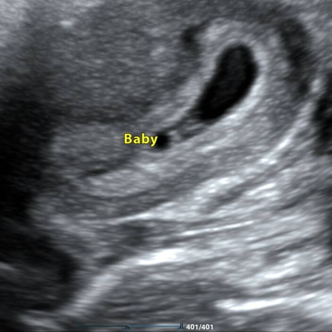 Photo shared by Sonny for their Babylist baby registry.