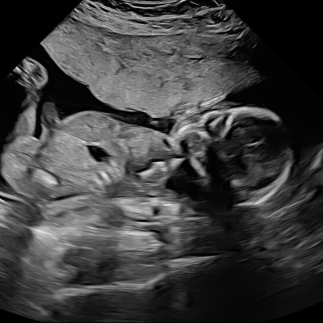 Photo shared by Noelle for their Babylist baby registry.