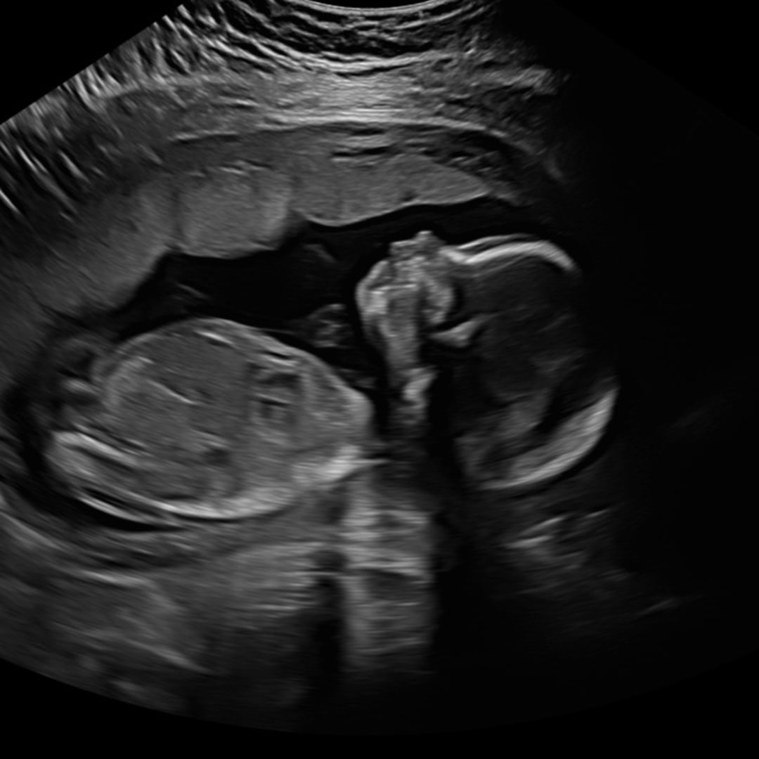 Photo shared by Breanna for their Babylist baby registry.