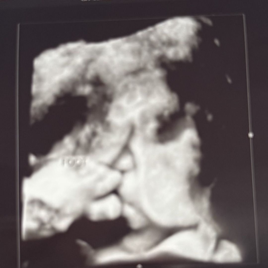 Photo shared by Chantel Maria for their Babylist baby registry.