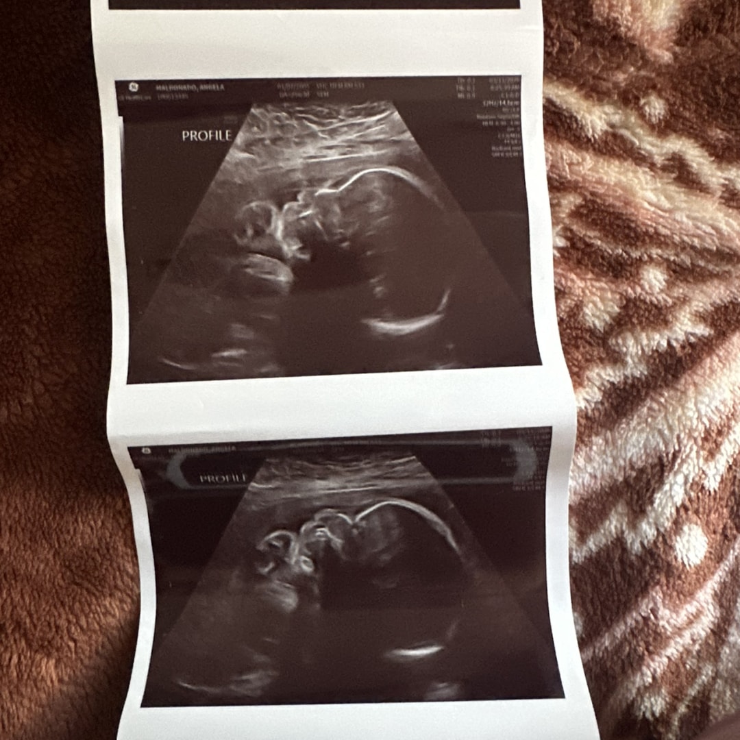 Photo shared by Angela for their Babylist baby registry.