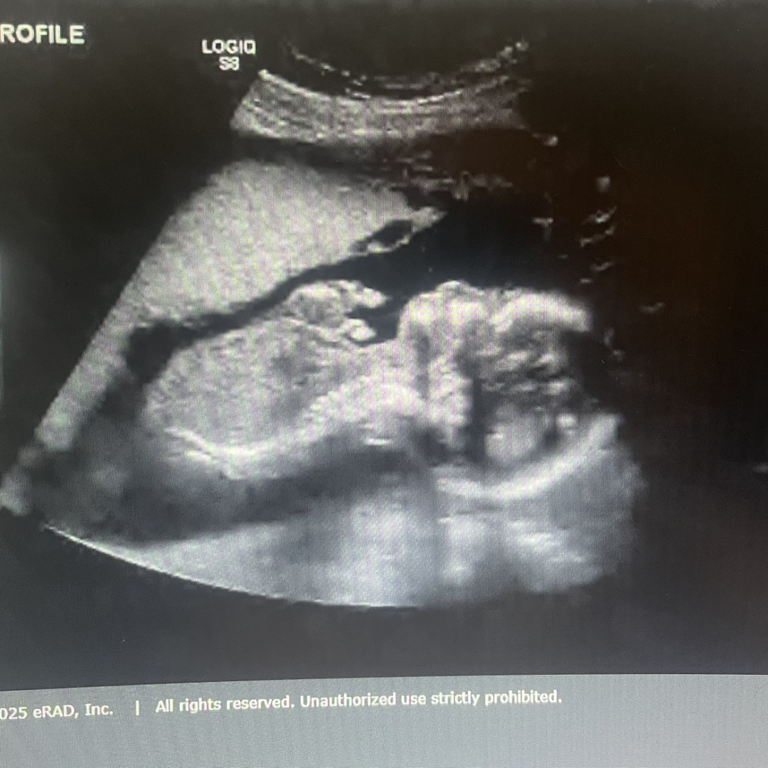 Photo shared by Jaclyn for their Babylist baby registry.