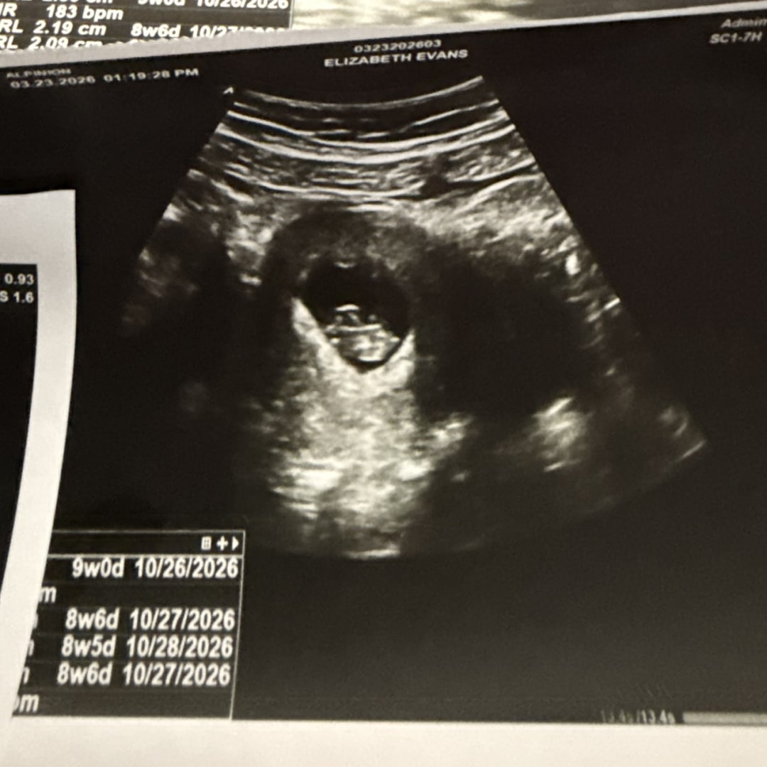 Photo shared by Elizabeth for their Babylist baby registry.