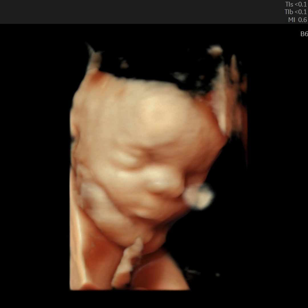 Photo shared by Catherine for their Babylist baby registry.