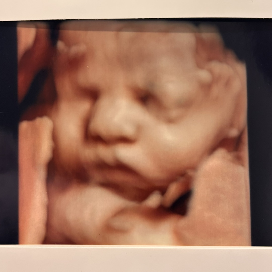 Photo shared by Mitzi for their Babylist baby registry.