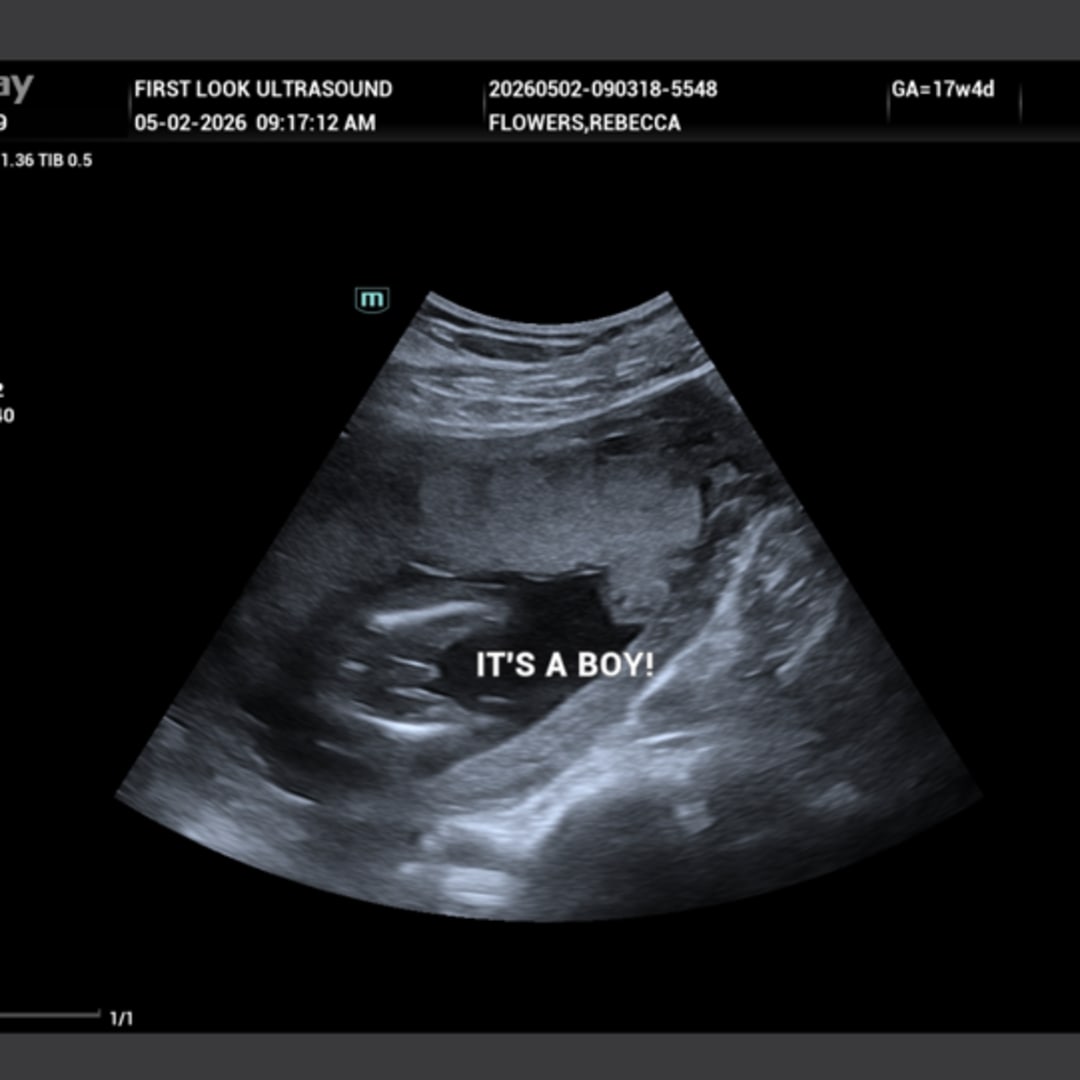 Photo shared by Rebecca for their Babylist baby registry.