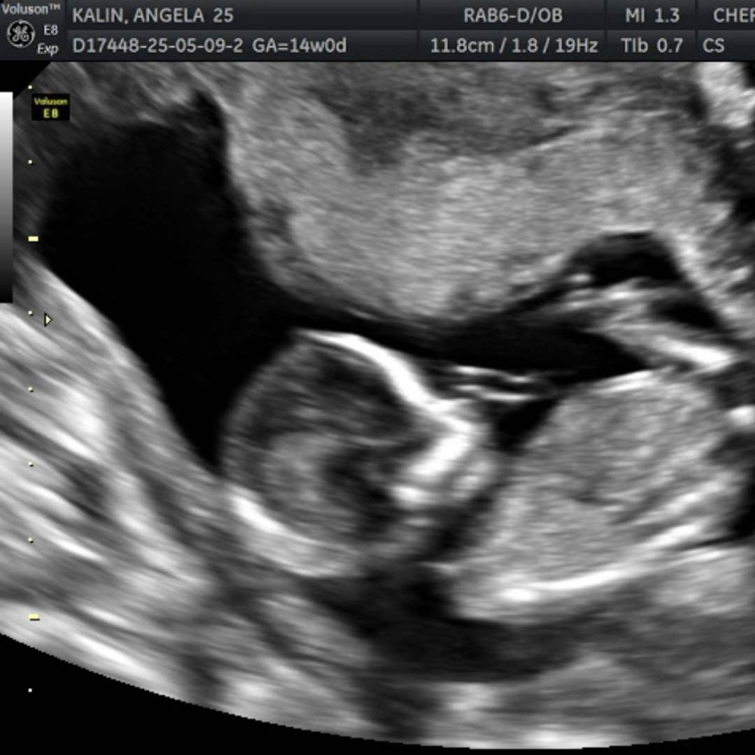 Photo shared by Angela for their Babylist baby registry.