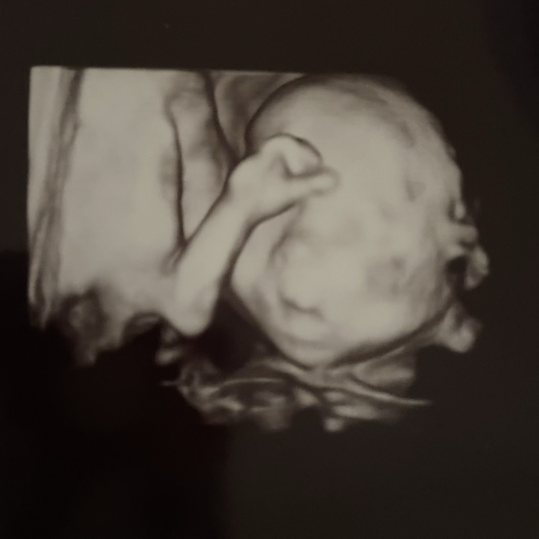 Photo shared by Aidan for their Babylist baby registry.