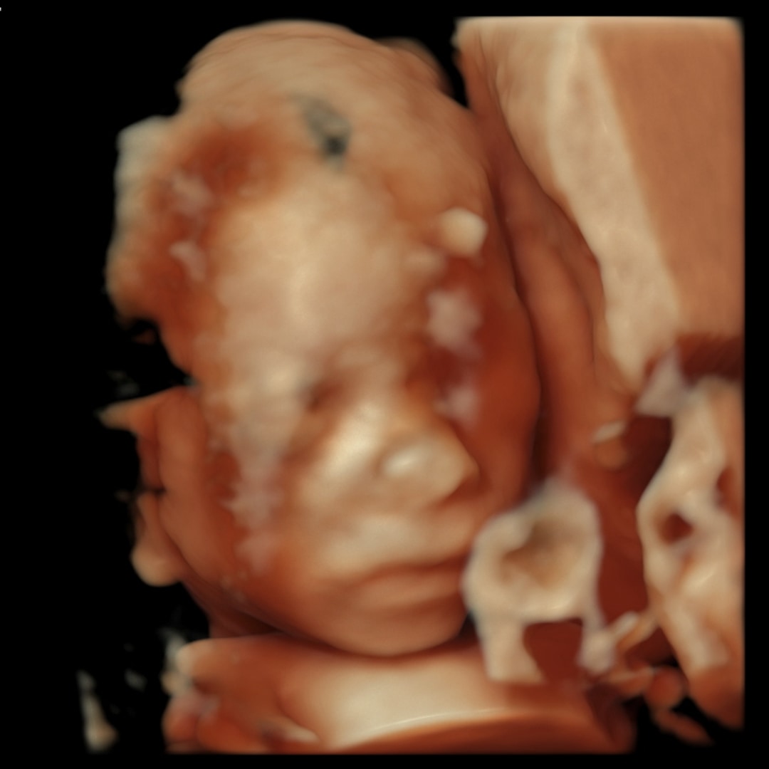 Photo shared by Jade for their Babylist baby registry.