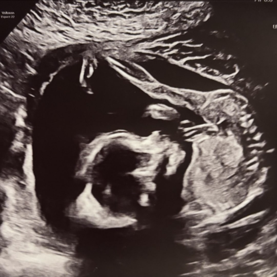 Photo shared by Lindsey for their Babylist baby registry.