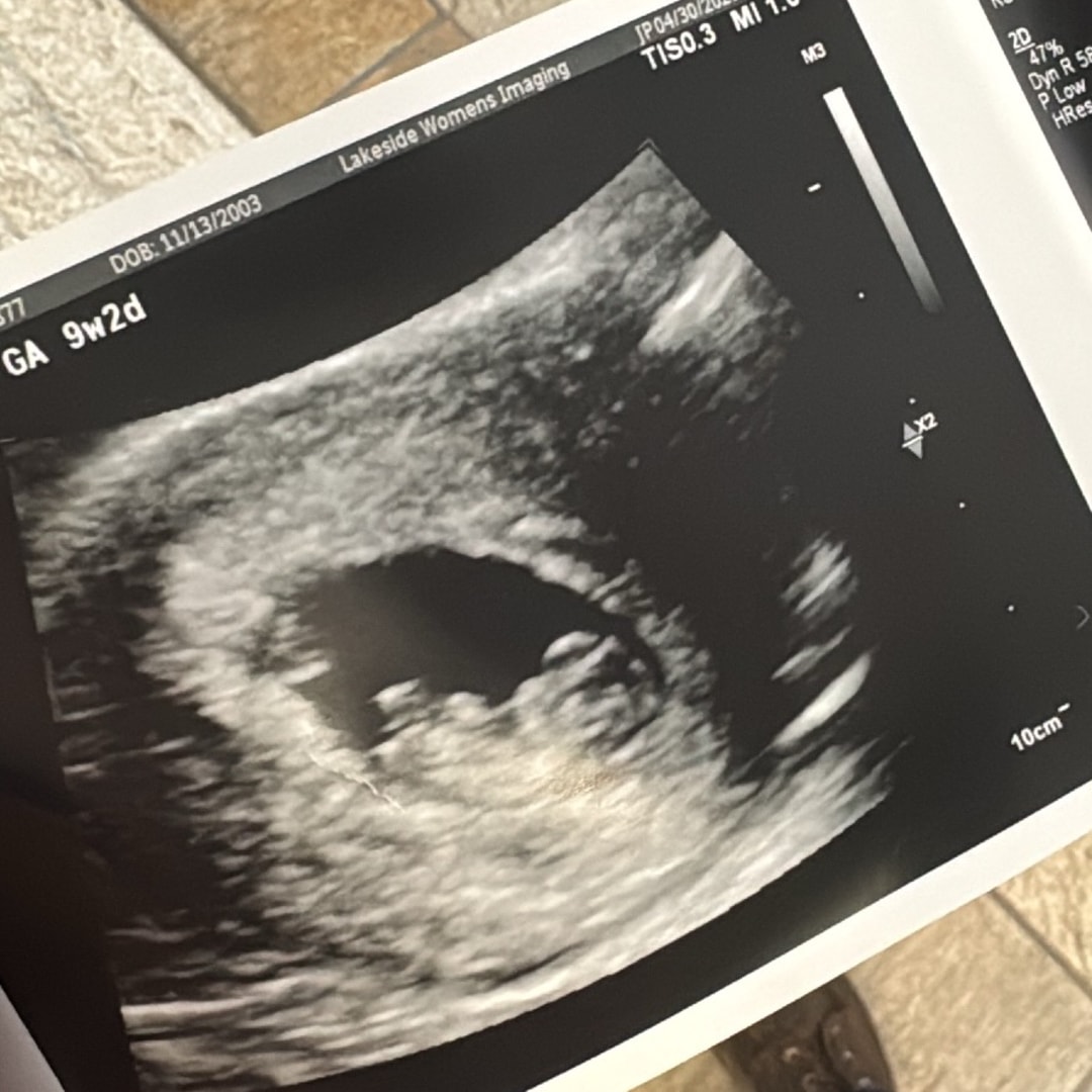 Photo shared by Lillie for their Babylist baby registry.