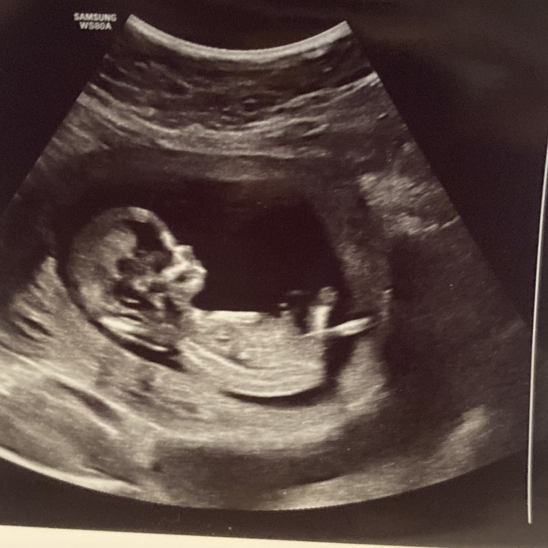 Photo shared by Jacqueline for their Babylist baby registry.