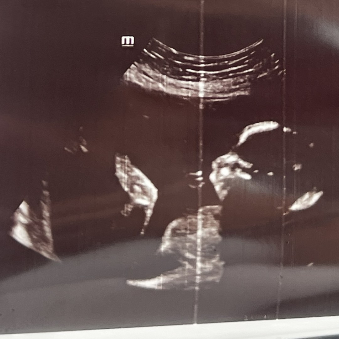Photo shared by Amber for their Babylist baby registry.
