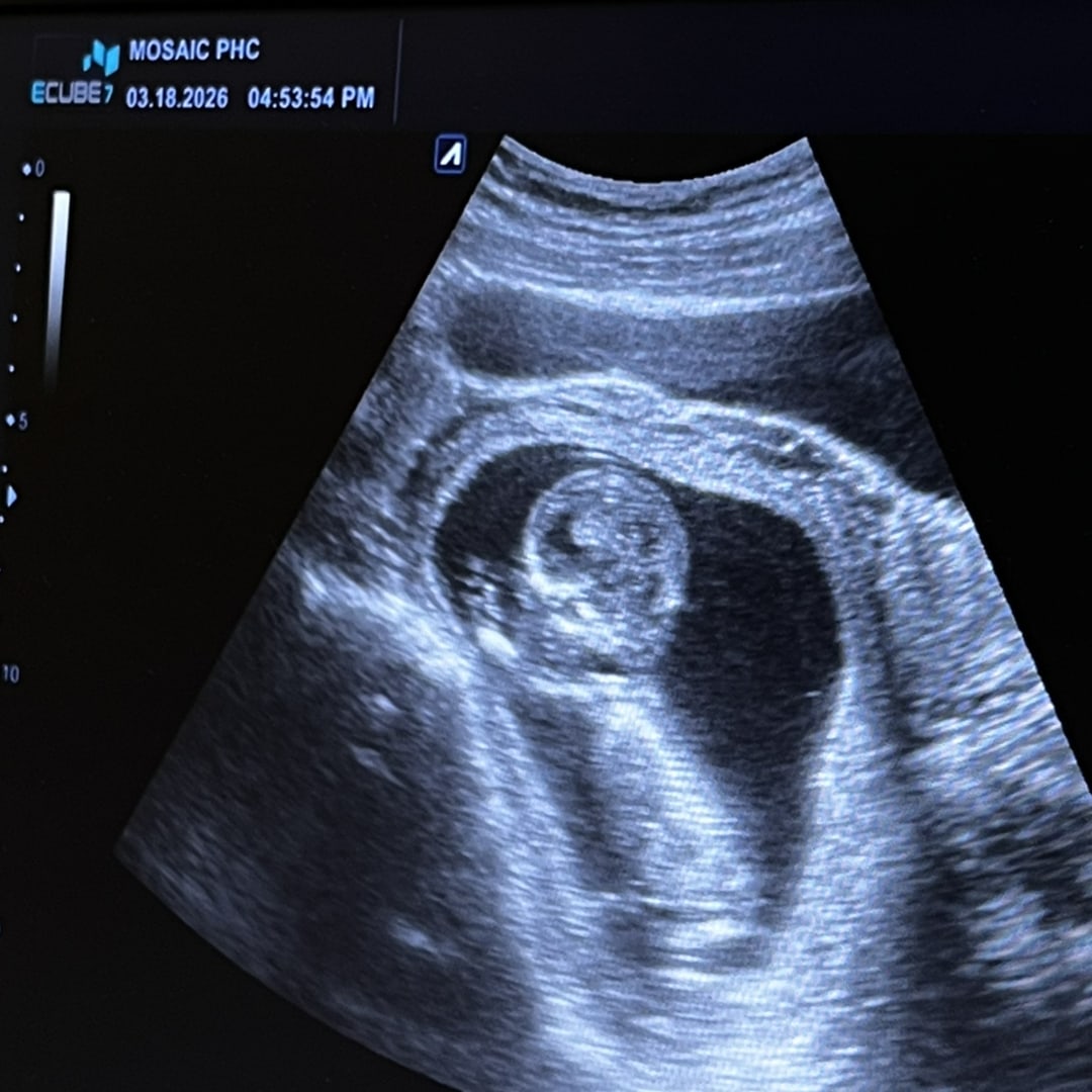 Photo shared by Clare for their Babylist baby registry.