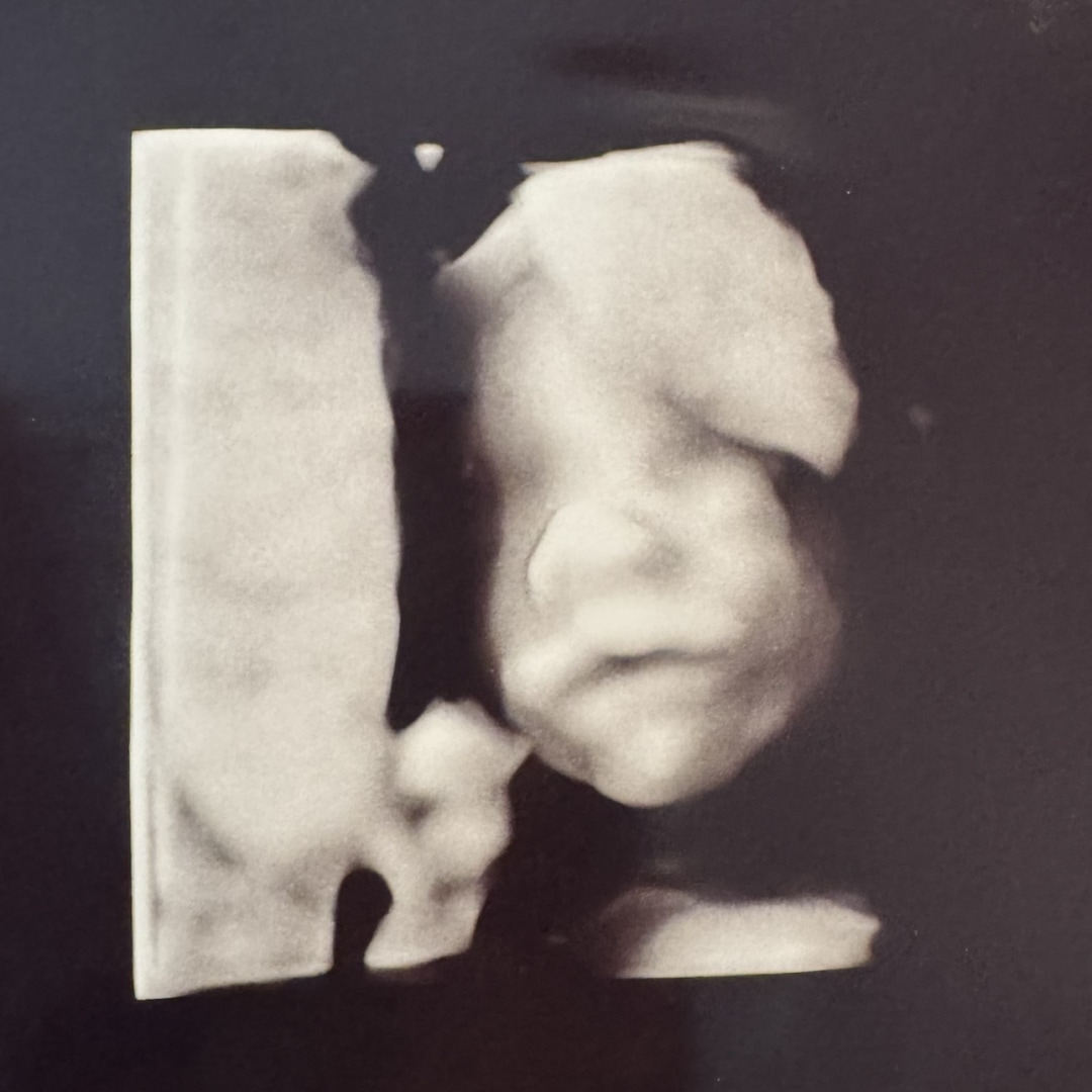 Photo shared by Kaia for their Babylist baby registry.