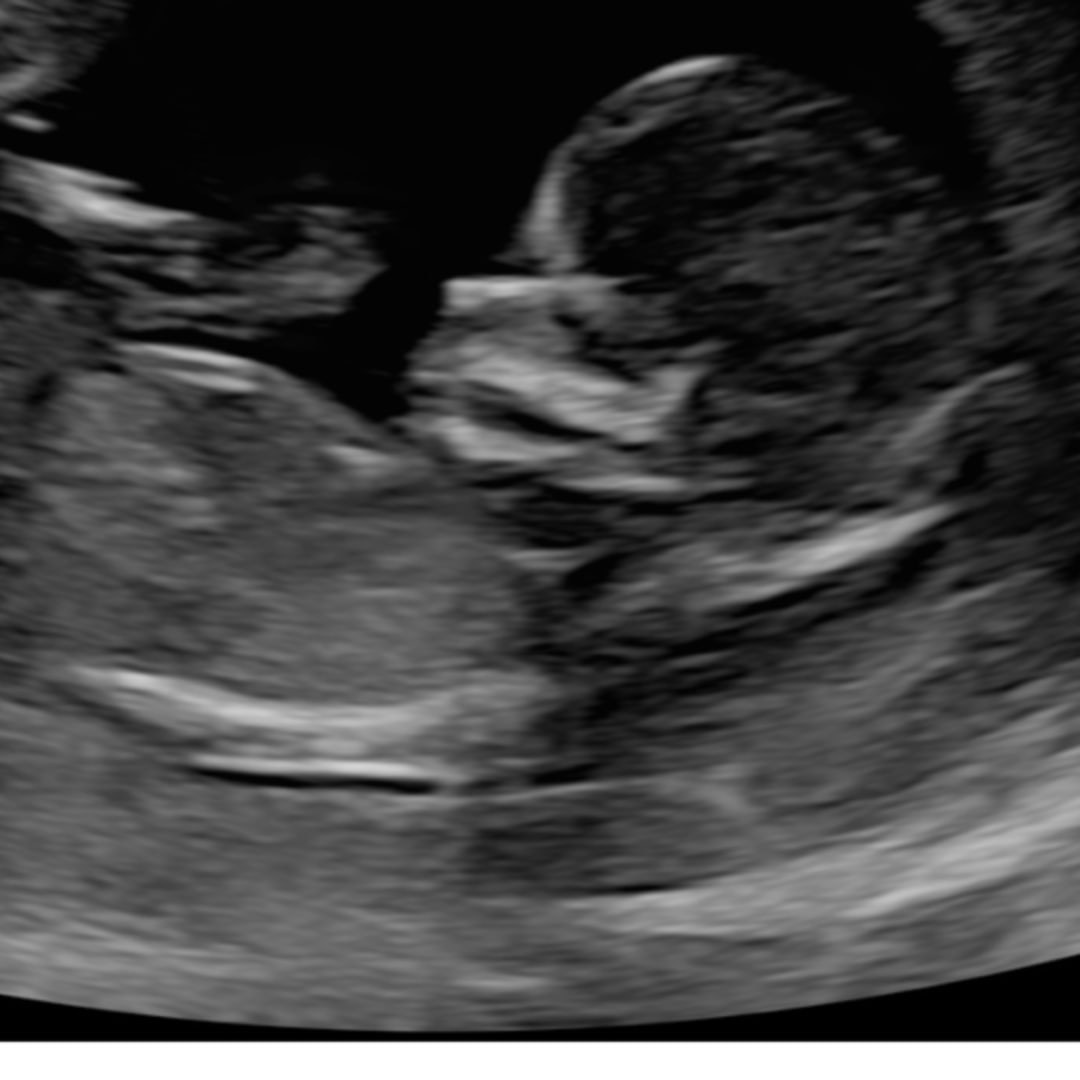 Photo shared by Rylee for their Babylist baby registry.