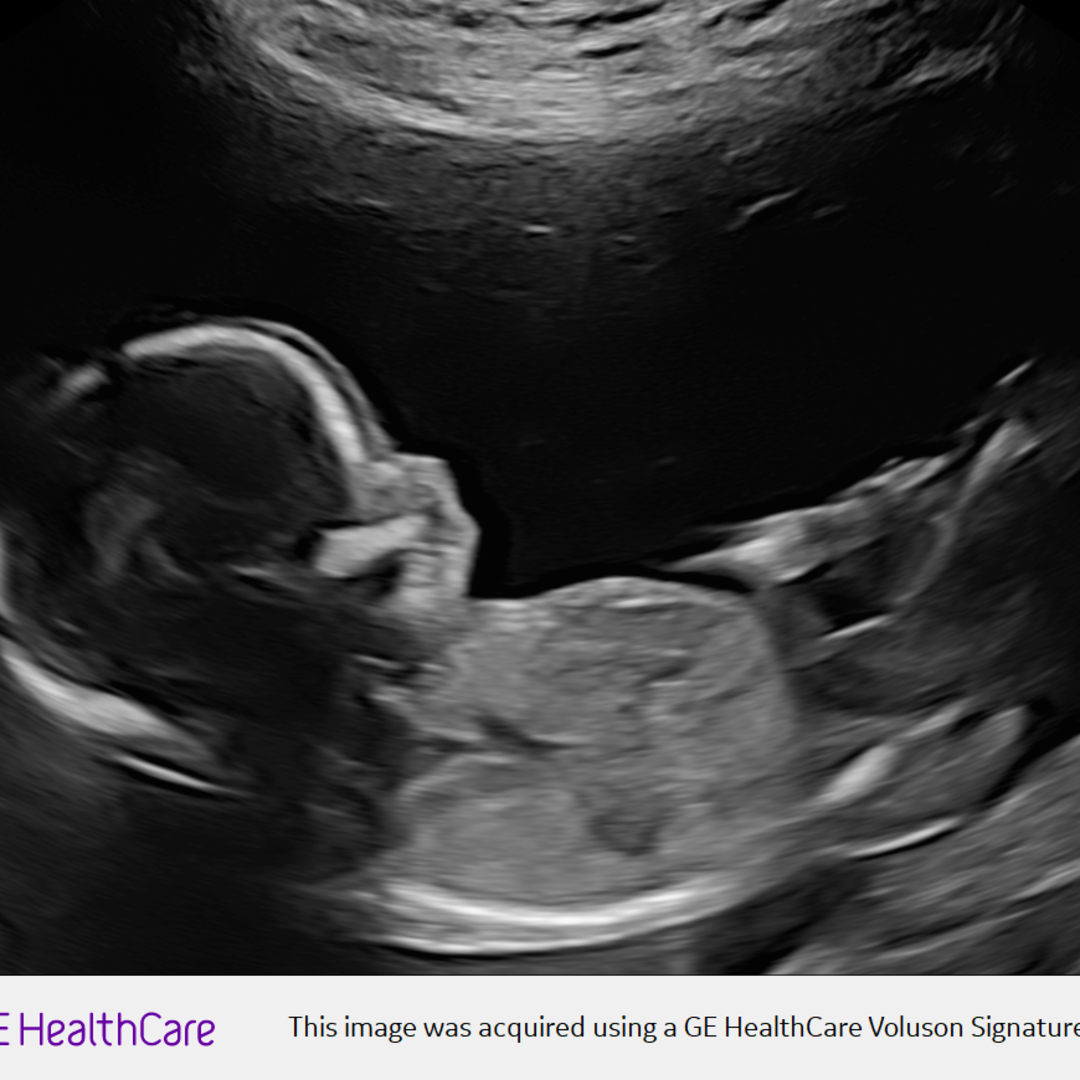 Photo shared by Samantha for their Babylist baby registry.